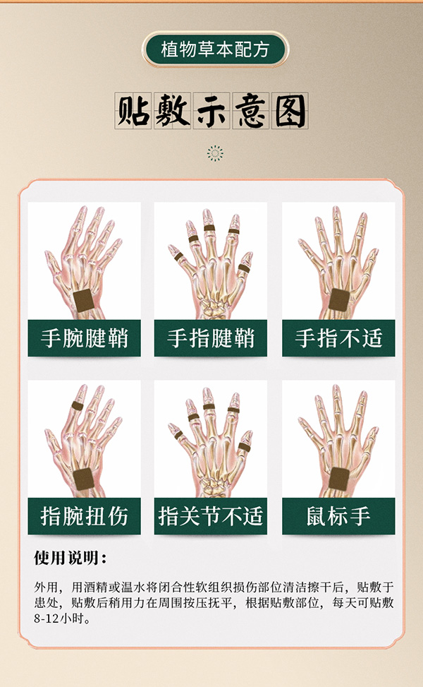 手指腱鞘炎貼 (10).jpg