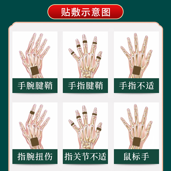 手指腱鞘炎貼 (3).jpg