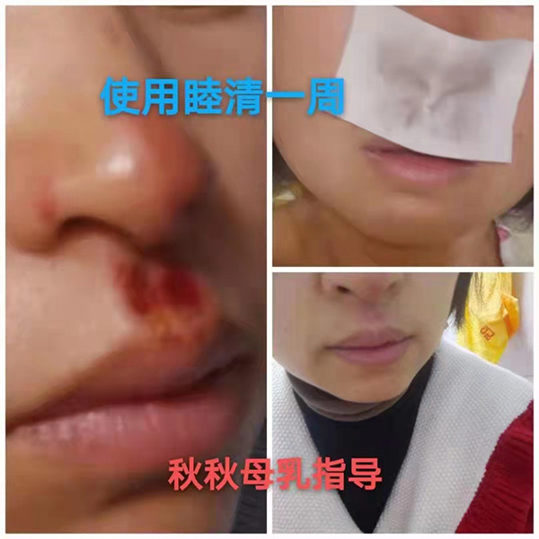 �����澏���N���Æ������M�߿ڱ������������a(ch��n)ƷȦ�۟o��(sh��)